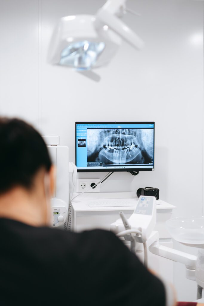 ¿Cuál es la causa de la Pérdida de hueso dental?