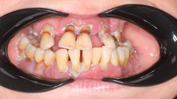 Noguera clinica dental antes Pilar