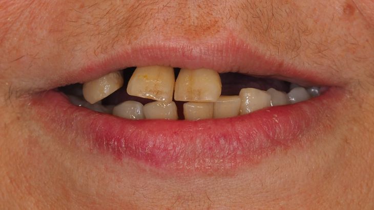 Noguera clinica dental antes Pilar