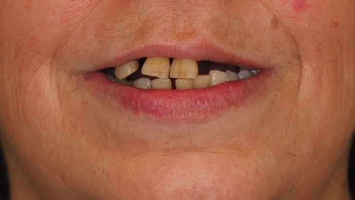 Noguera clinica dental antes Pilar