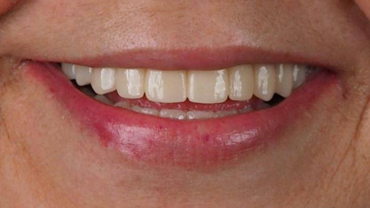 Noguera clinica dental despues Pilar